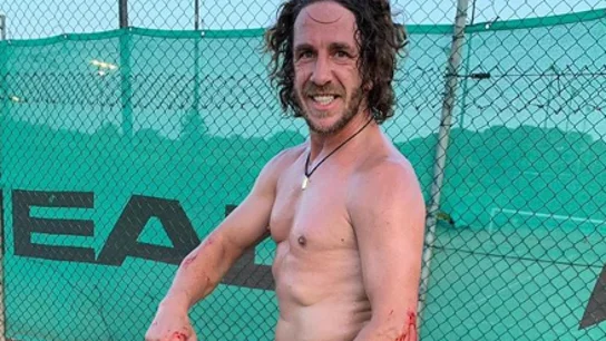 Puyol, tras su incidente con el pádel Puyol, tras su incidente con el pádel