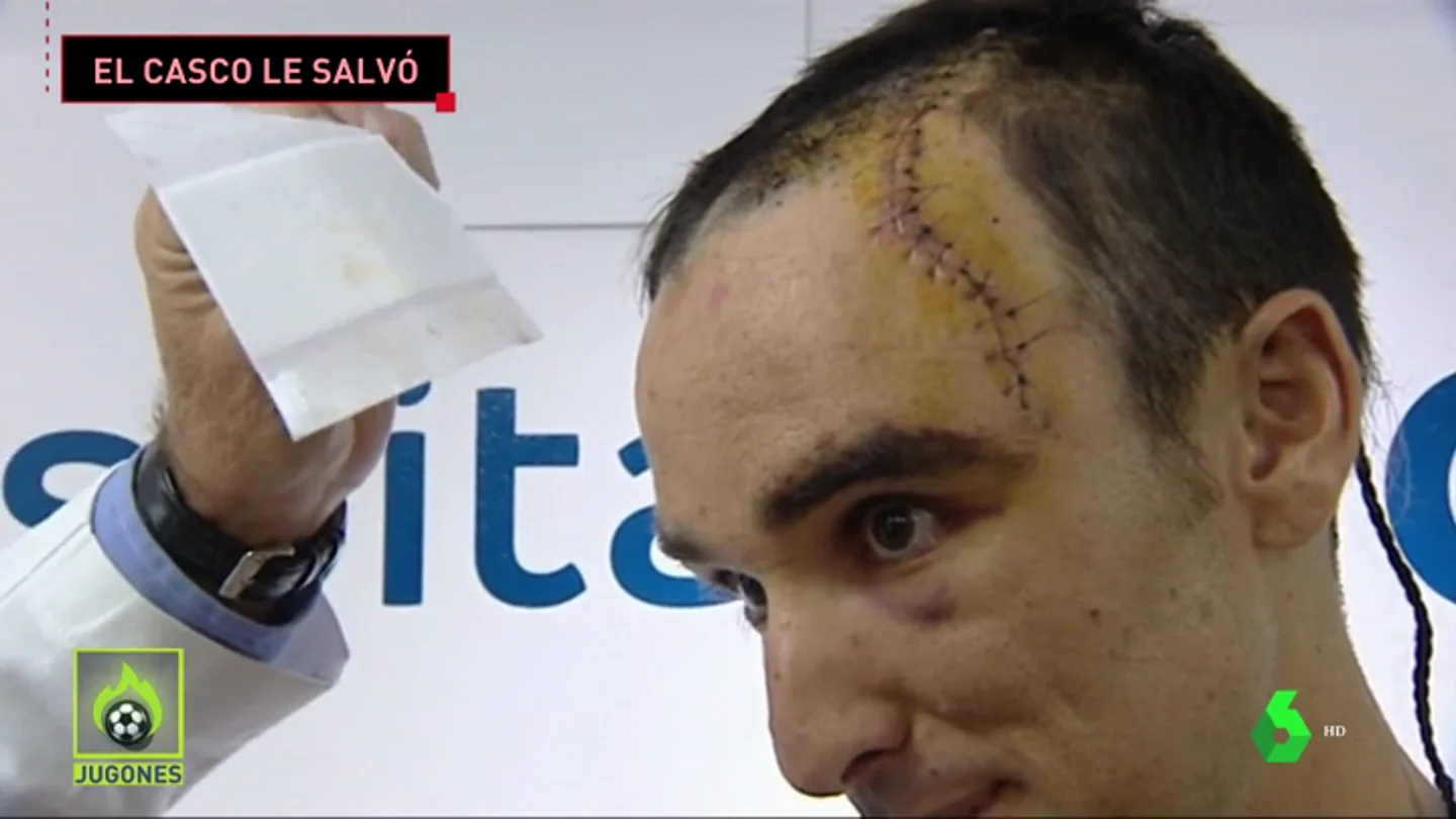 La grave caída de Luis Ángel Maté en la Vuelta a Polonia: más de 50 puntos de sutura y el casco le salvó la vida La grave caída de Luis Ángel Maté en la Vuelta a Polonia: más de 50 puntos de sutura y el casco le salvó la vida