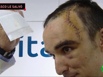 La grave caída de Luis Ángel Maté en la Vuelta a Polonia: más de 50 puntos de sutura y el casco le salvó la vida La grave caída de Luis Ángel Maté en la Vuelta a Polonia: más de 50 puntos de sutura y el casco le salvó la vida