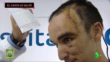 La grave caída de Luis Ángel Maté en la Vuelta a Polonia: más de 50 puntos de sutura y el casco le salvó la vida