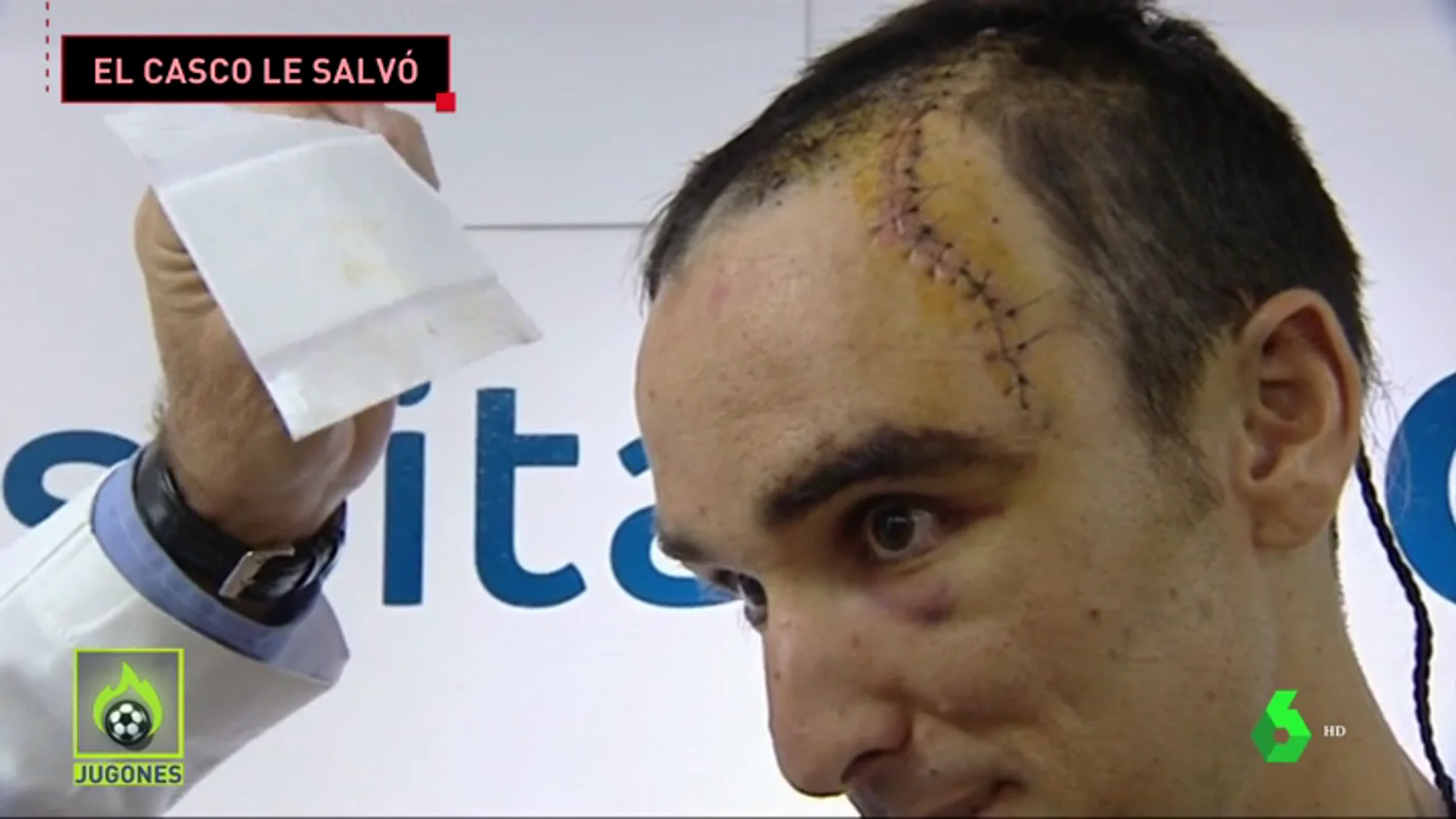 La grave caída de Luis Ángel Maté en la Vuelta a Polonia: más de 50 puntos de sutura y el casco le salvó la vida