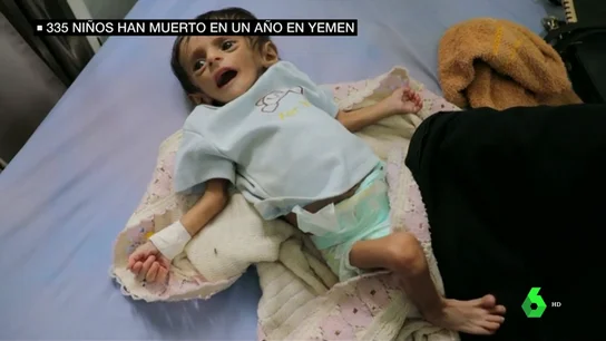 335 muertos y 600 heridos: la escalofriante cifra de víctimas infantiles en Yemen en un año 335 muertos y 600 heridos: la escalofriante cifra de víctimas infantiles en Yemen en un año