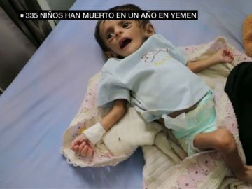 335 muertos y 600 heridos: la escalofriante cifra de víctimas infantiles en Yemen en un año 335 muertos y 600 heridos: la escalofriante cifra de víctimas infantiles en Yemen en un año
