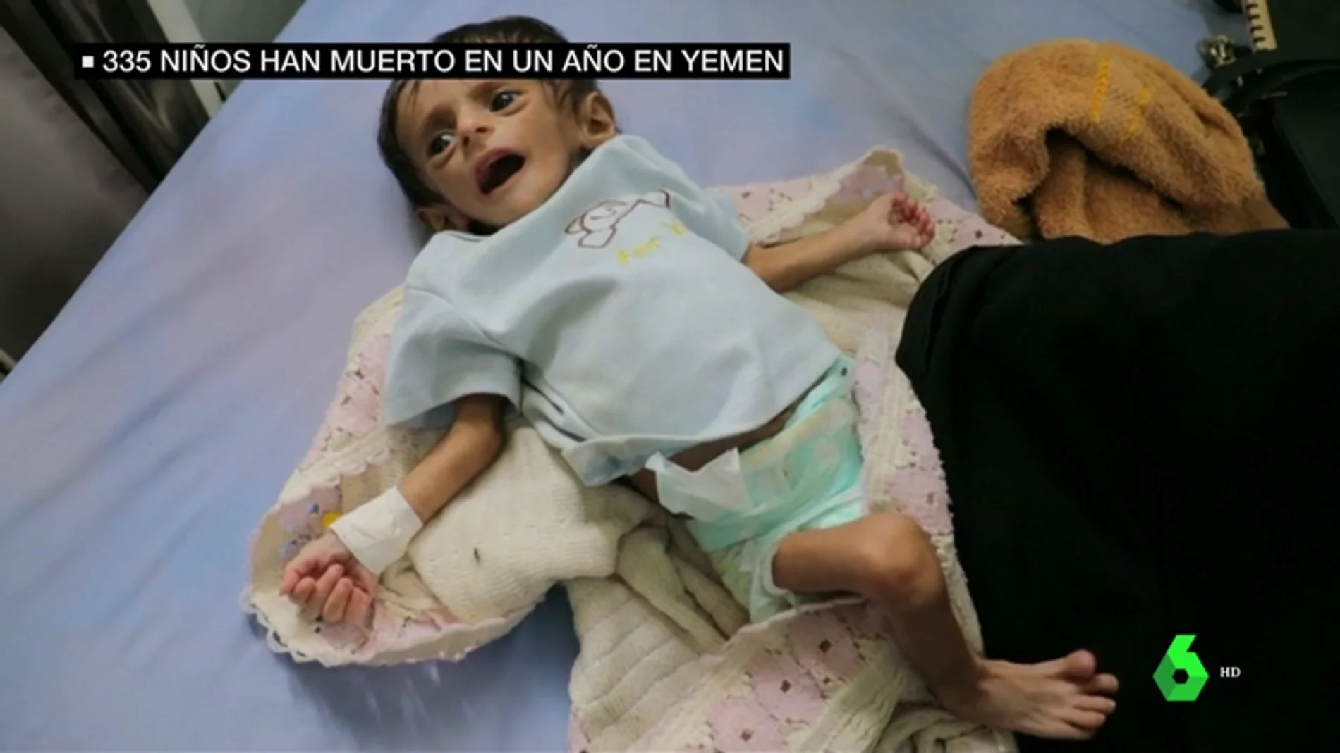 335 muertos y 600 heridos: la escalofriante cifra de víctimas infantiles en Yemen en un año 