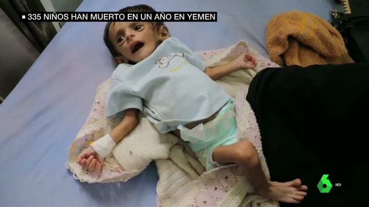 335 muertos y 600 heridos: la escalofriante cifra de víctimas infantiles en Yemen en un año 