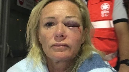 Karen Sadler, australiana que ha denunciado la agresión Karen Sadler, australiana que ha denunciado la agresión