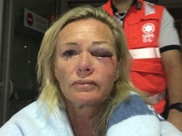 Karen Sadler, australiana que ha denunciado la agresión Karen Sadler, australiana que ha denunciado la agresión