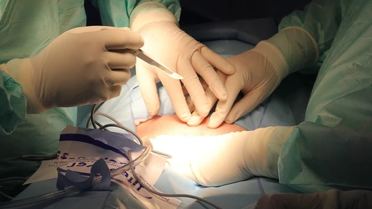 Cirujanos realizando una operación Cirujanos realizando una operación.