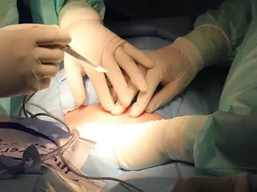 Cirujanos realizando una operación 