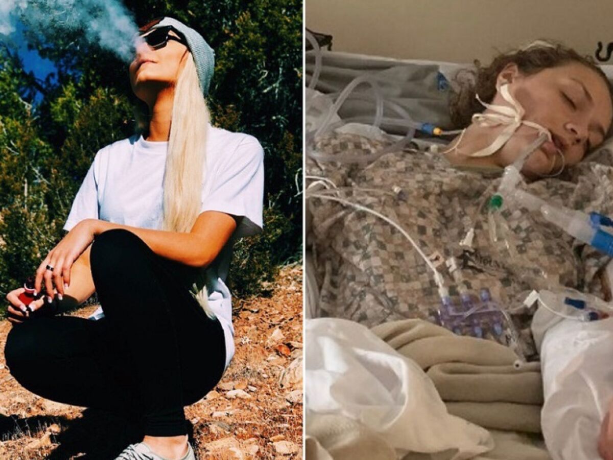 Vapeo: una joven acaba en coma inducido por una neumona causada por  consumir un cigarrillo electrnico