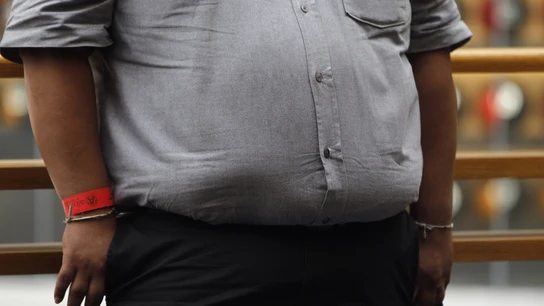 Un hombre con obesidad Un hombre con obesidad