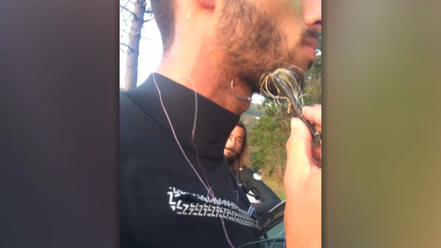 Juan Olaizola salió del agua con el anzuelo clavado en el cuello Juan Olaizola salió del agua con el anzuelo clavado en el cuello