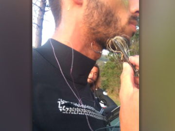 Juan Olaizola salió del agua con el anzuelo clavado en el cuello Juan Olaizola salió del agua con el anzuelo clavado en el cuello