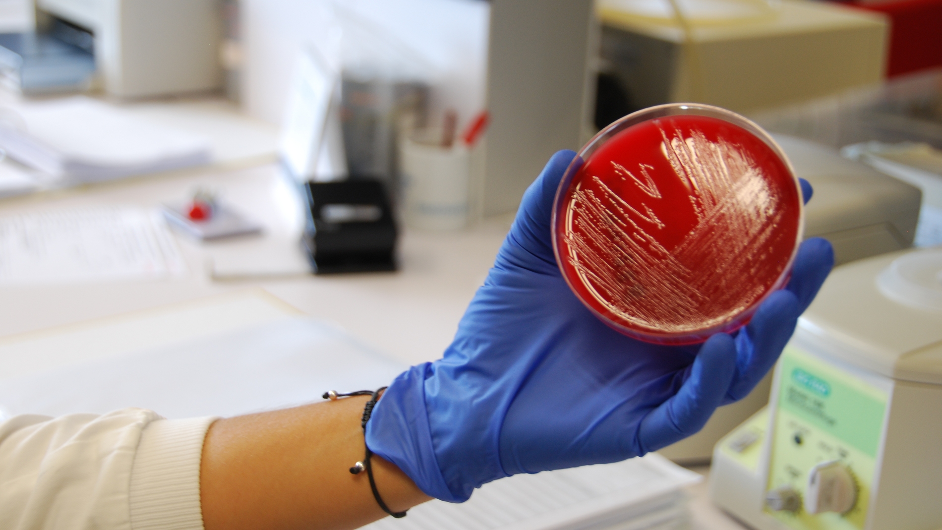 Visitamos los laboratorios que buscan el origen del brote de listeriosis