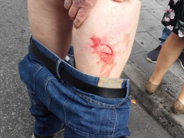 Imagen de uno de los heridos durante un desahucio en Alcorcón Imagen de uno de los heridos durante un desahucio en Alcorcón