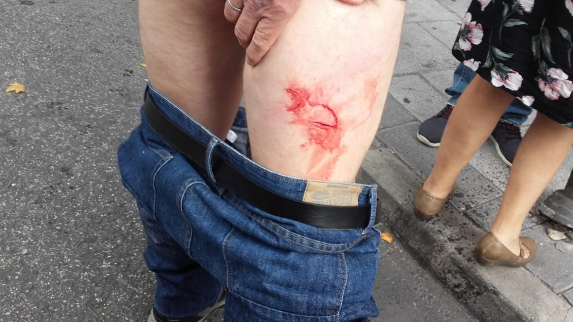 Imagen de uno de los heridos durante un desahucio en Alcorcón