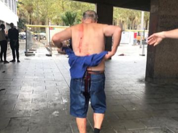 Imagen del hombre apuñalado en Barcelona Imagen del hombre apuñalado en Barcelona
