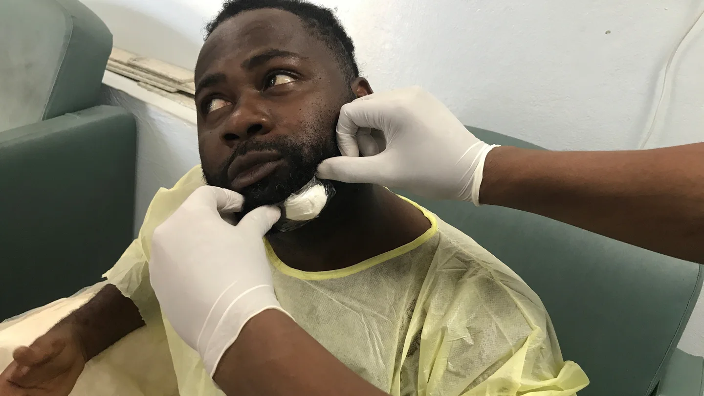 El fotoperiodista Chery Dieu-Nalio tras recibir un tiro en la barbilla por un senador haitiano El fotoperiodista Chery Dieu-Nalio tras recibir un tiro en la barbilla por un senador haitiano