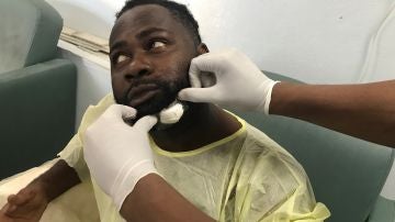 El fotoperiodista Chery Dieu-Nalio tras recibir un tiro en la barbilla por un senador haitiano