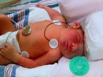 Lucas, el primer bebé que nace con medio cerebro fuera del cráneo y logra sobrevivir Lucas, el primer bebé que nace con medio cerebro fuera del cráneo y logra sobrevivir
