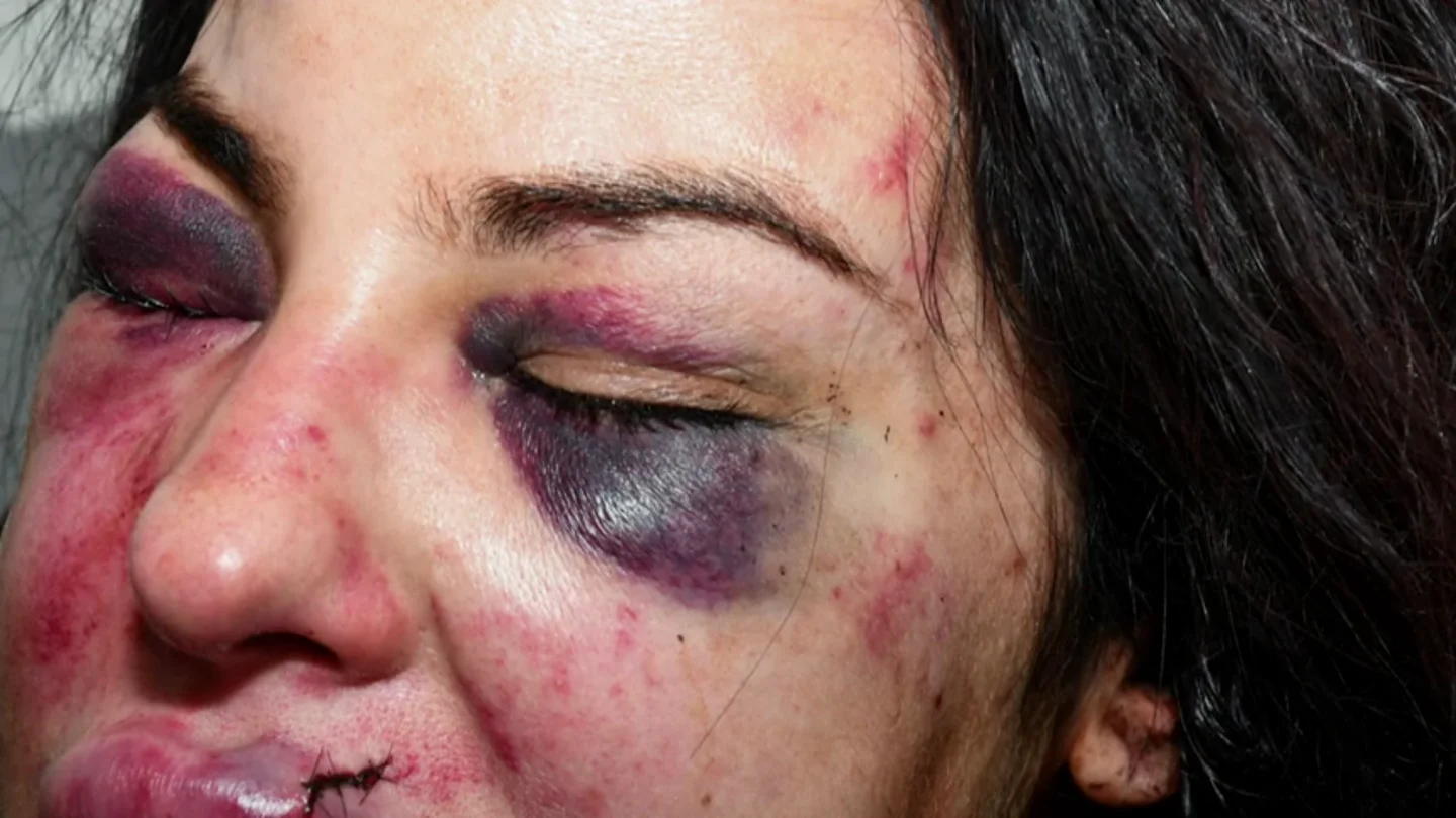 "¡Voy a matarte!": la estremecedora llamada de socorro de una mujer apuñalada por su exnovio "¡Voy a matarte!": la estremecedora llamada de socorro de una mujer apuñalada por su exnovio