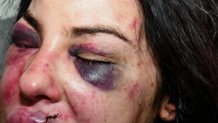"¡Voy a matarte!": la estremecedora llamada de socorro de una mujer apuñalada por su exnovio