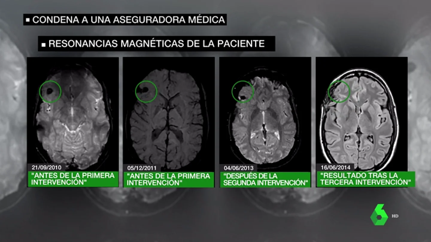 Dos médicos engañan a una menor de Madrid al decirle que le habían extirpado un tumor cuando seguía con él Dos médicos engañan a una menor de Madrid al decirle que le habían extirpado un tumor cuando seguía con él