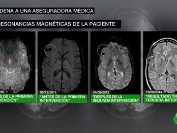 Dos médicos engañan a una menor de Madrid al decirle que le habían extirpado un tumor cuando seguía con él Dos médicos engañan a una menor de Madrid al decirle que le habían extirpado un tumor cuando seguía con él