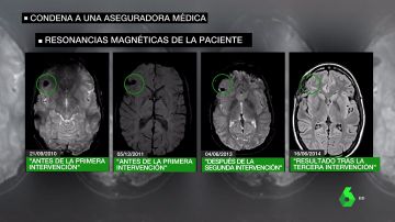 Dos médicos engañan a una menor de Madrid al decirle que le habían extirpado un tumor cuando seguía con él