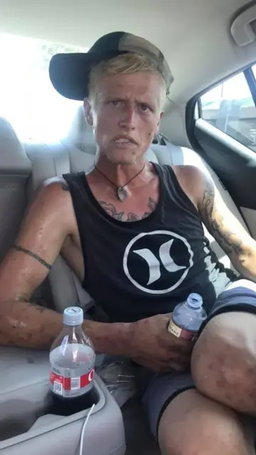 Imagen de Cody Bishop demacrado por la heroína Imagen de Cody Bishop demacrado por la heroína