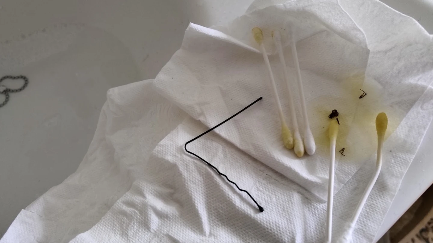 Bastoncillos con los que Liam Gómez sacó una araña de su oído Bastoncillos con los que Liam Gómez sacó una araña de su oído