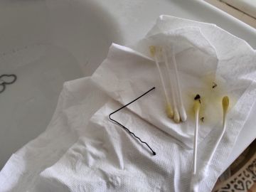 Bastoncillos con los que Liam Gómez sacó una araña de su oído Bastoncillos con los que Liam Gómez sacó una araña de su oído