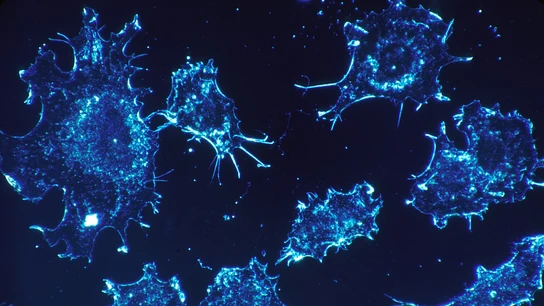 Células cancerosas Células cancerosas