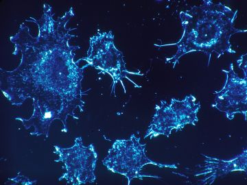 Células cancerosas Células cancerosas