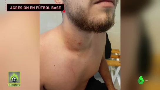 Un padre agrede brutalmente a un árbitro en un partido de alevines Un padre agrede brutalmente a un árbitro en un partido de alevines
