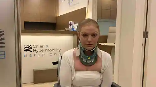 Rachel Pighills padece una enfermedad que le impide girar el cuello hacia la izquierda. Rachel Pighills padece una enfermedad que le impide girar el cuello hacia la izquierda.