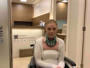Rachel Pighills padece una enfermedad que le impide girar el cuello hacia la izquierda. Rachel Pighills padece una enfermedad que le impide girar el cuello hacia la izquierda.