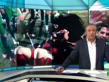 Agreden a un portero del Xerez Deportivo durante el derbi contra el Xerez CD Agreden a un portero del Xerez Deportivo durante el derbi contra el Xerez CD
