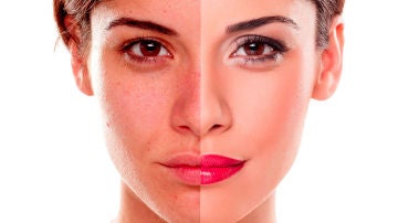 Rostro retocado