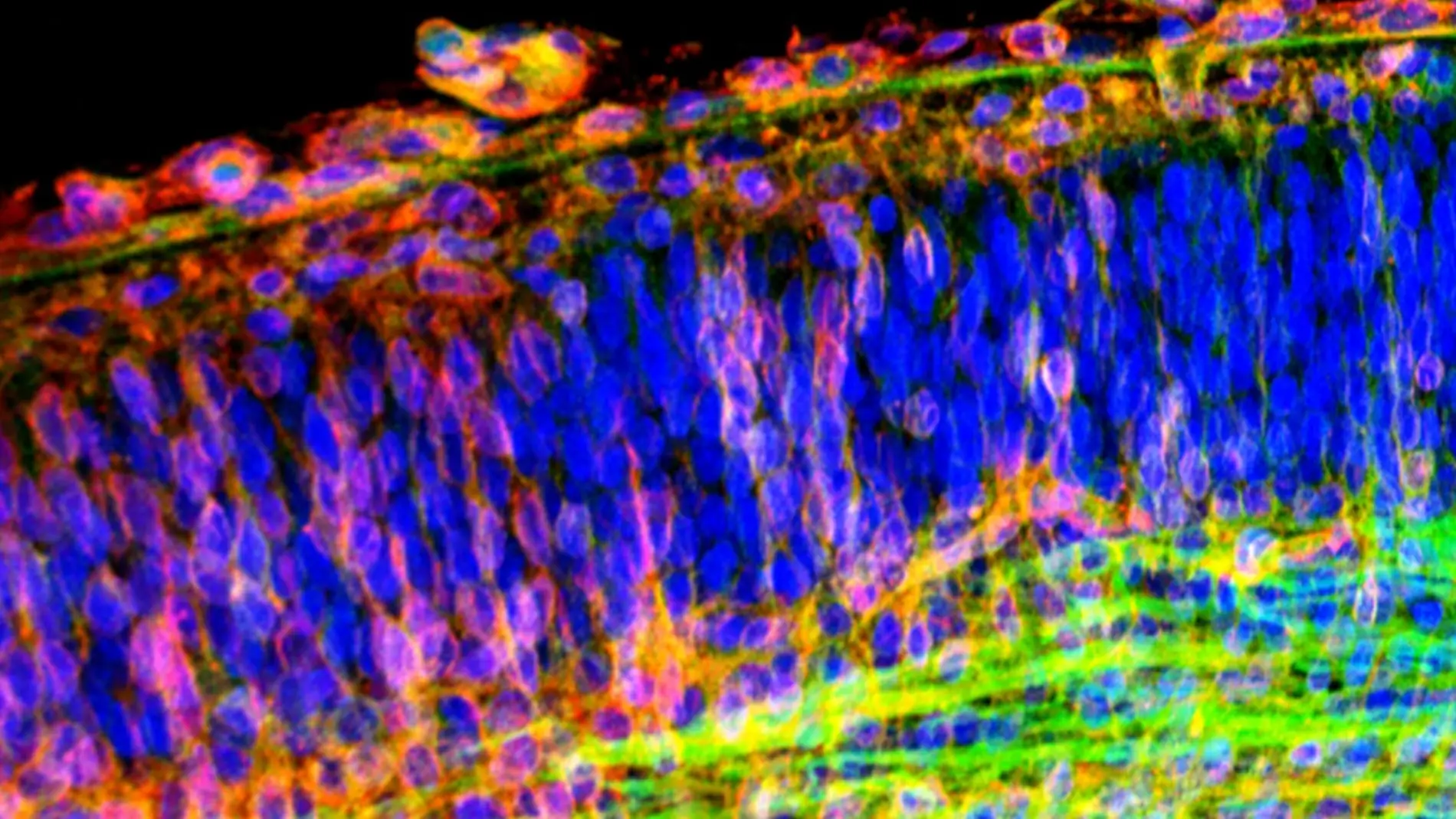 Imagen del cerebro captada mediante microscopia láser confocal donde se observan las neuronas (azul) y sus axones en crecimiento (rojo y verde). Autor: INc-UAB