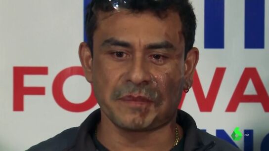 La v&iacute;ctima del ataque racista