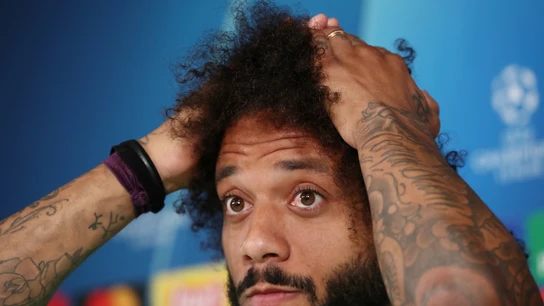 Marcelo se lleva las manos a la cabeza ante los medios Marcelo se lleva las manos a la cabeza ante los medios