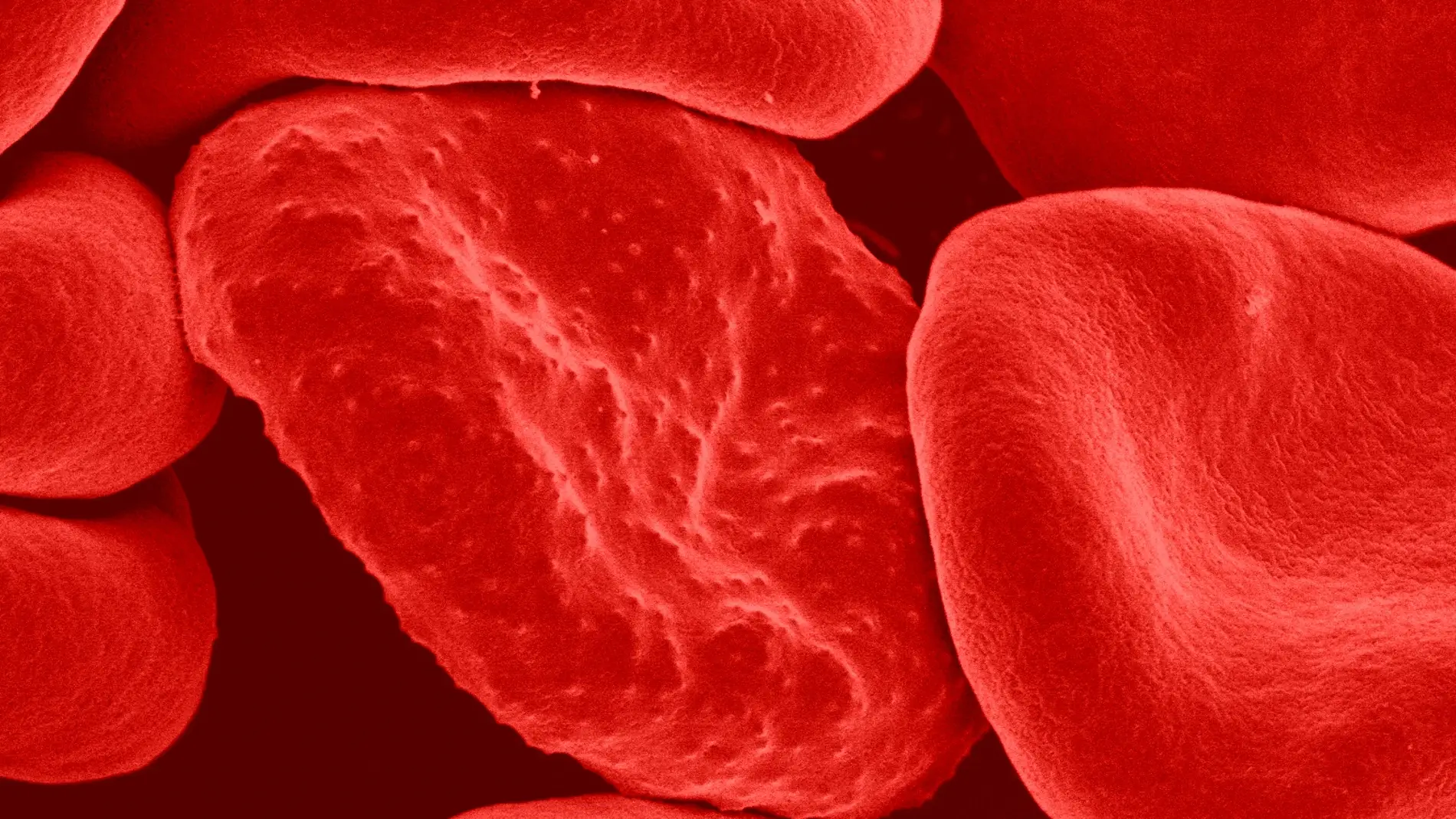 Revelado el mecanismo de accion de farmacos utilizados contra la malaria