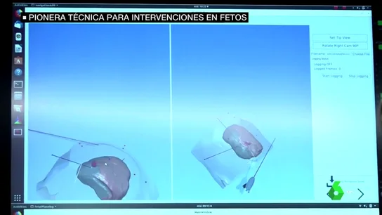 Gemelos Gemelos