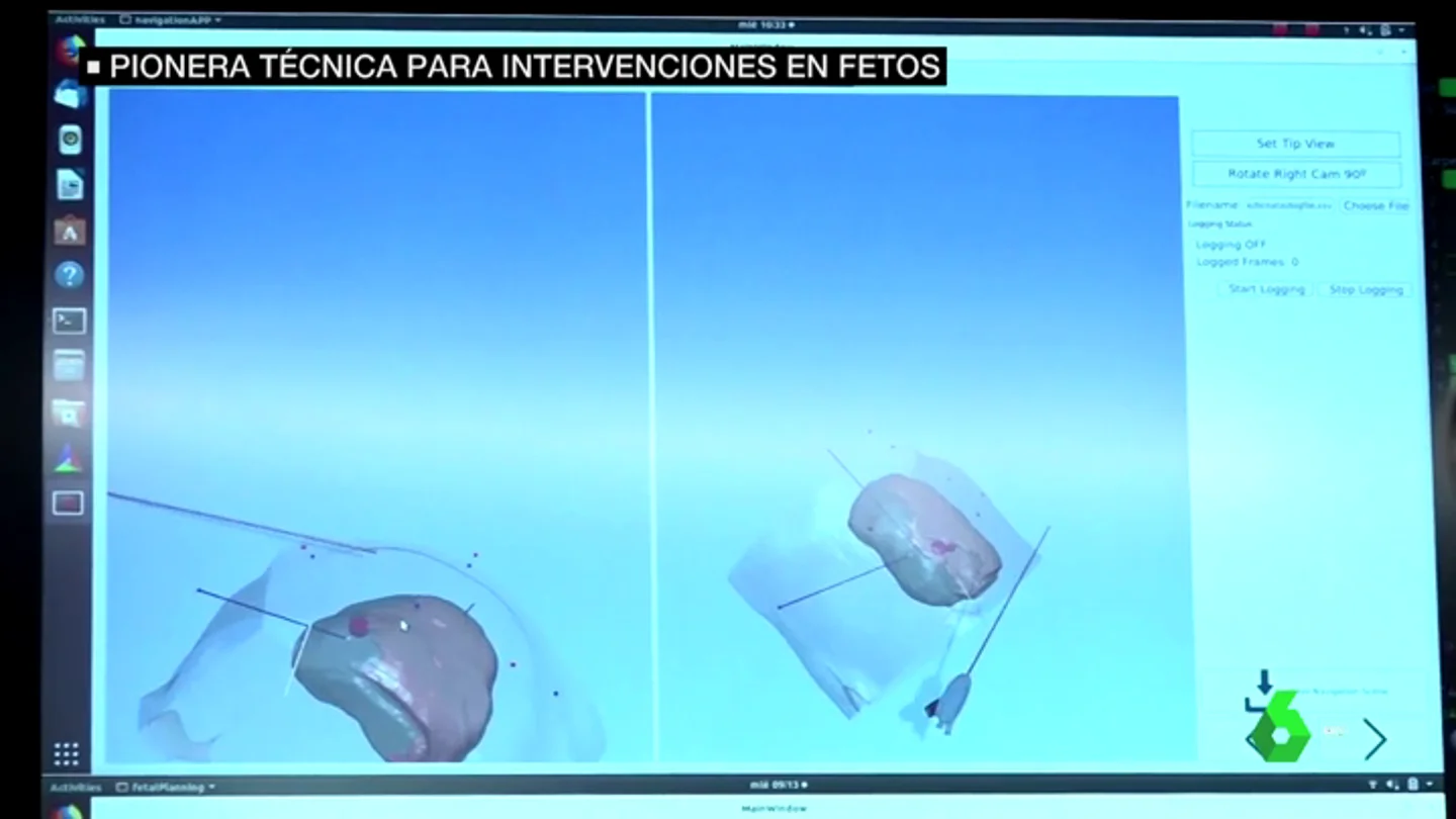 Gemelos Gemelos