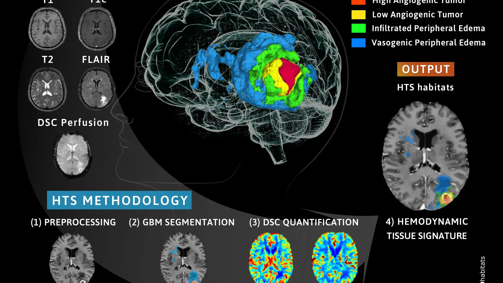 Nueva plataforma para ayudar al pronostico y seguimiento de pacientes con glioblastoma