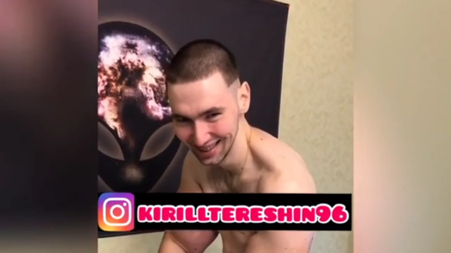 Kirill Tereshin enseña la carne que le han quitado en su operación Kirill Tereshin enseña la carne que le han quitado en su operación