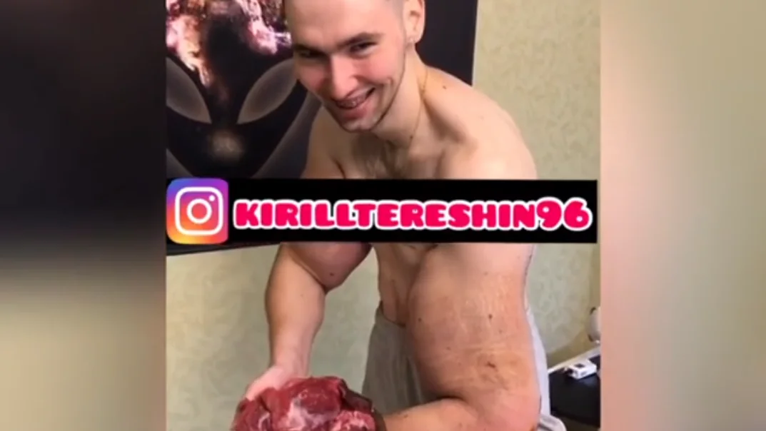 Kirill Tereshin enseña la carne que le han quitado en su operación