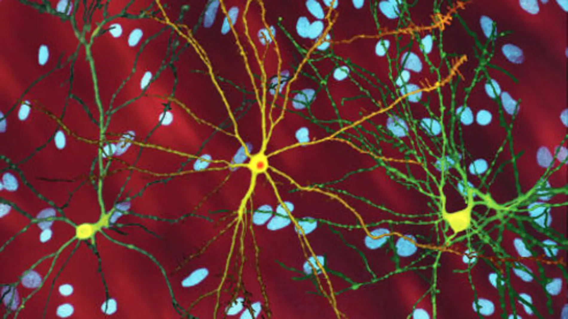 Imagen de microscopio de las neuronas espinosas medias