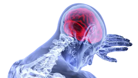 Cerebro Cerebro